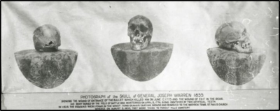 Joseph Warren skull