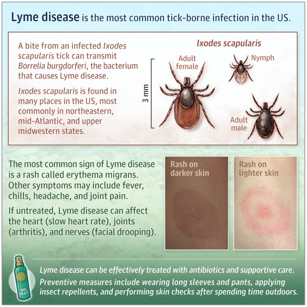 Lyme and Ticks